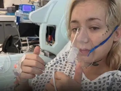 Tüdőrákot diagnosztizáltak a fiatal lánynál aki 15 éves kora óta vape-et szívott