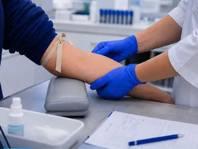 A laborosok szinte könyörögve kérik: ha vérvételre vagy vizeletvizsgálatra mész, ezt feltétlenül tudd